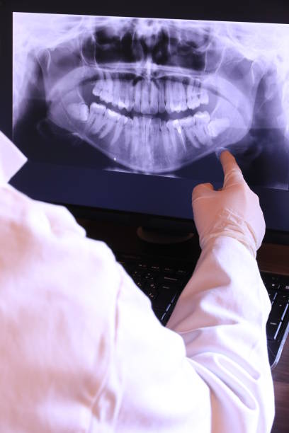 Best Emergency Dentist for Lost Fillings or Crowns in Lewiston, ID