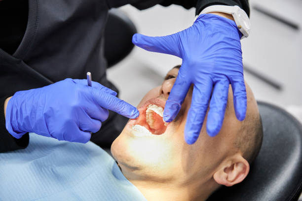 Best Emergency Dentist for Knocked-Out Tooth in Lewiston, ID
